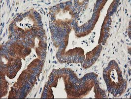 m00960 anti bcar1 mouse monoclonal antibody clone id oti1b1 ihc testing 6