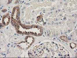 m00960 anti bcar1 mouse monoclonal antibody clone id oti1b1 ihc testing 7