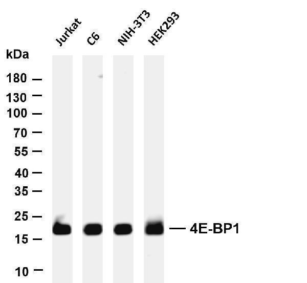 Various whole cell lysates were separated by 4-20% SDS-PAGE, and the membrane was blotted with anti-4E-BP1 antibody