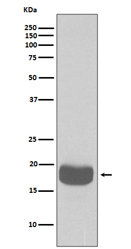 Western blot analysis of eIF4EBP1 expression in K562 cell lysate.