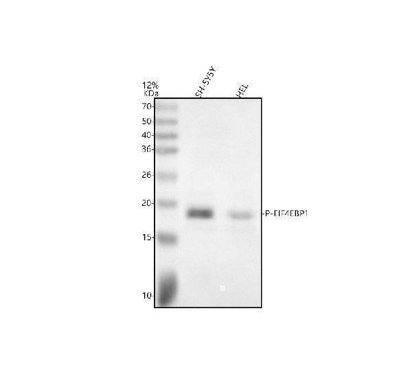 Western blot analysis of P-EIF4EBP1 using anti-P-EIF4EBP1 antibody (M00968T70)