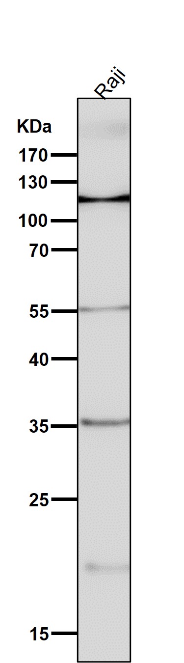 All lanes use the Antibody at 1:5K dilution for 1 hour at room temperature.