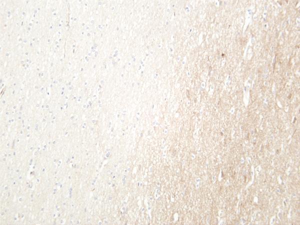 Humanbrain was stained with anti-LRP6 rabbit antibody
