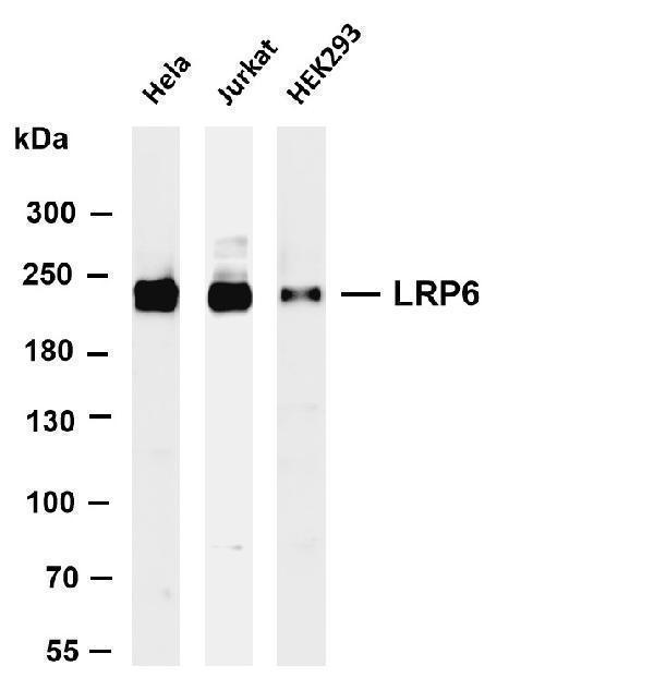 Various whole cell lysates were separated by 4-8% SDS-PAGE, and the membrane was blotted with anti-LRP6 antibody