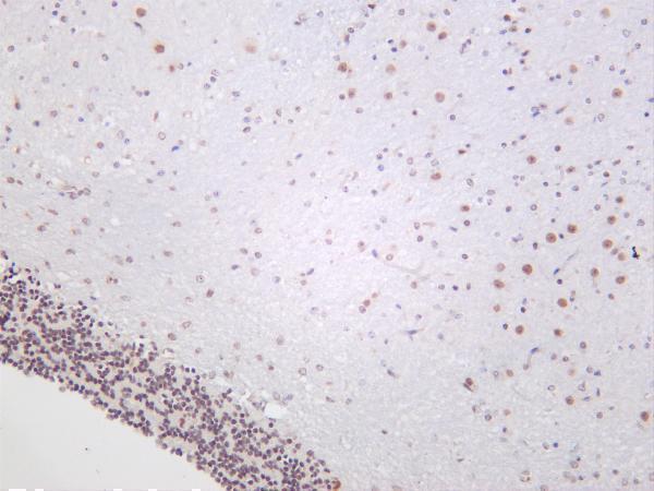 Mouse brain was stained with anti-HDAC4 rabbit antibody