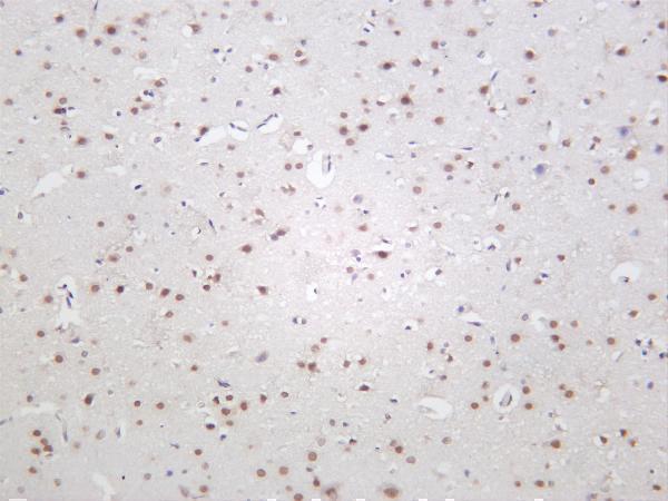 Rat brain was stained with anti-HDAC4 rabbit antibody