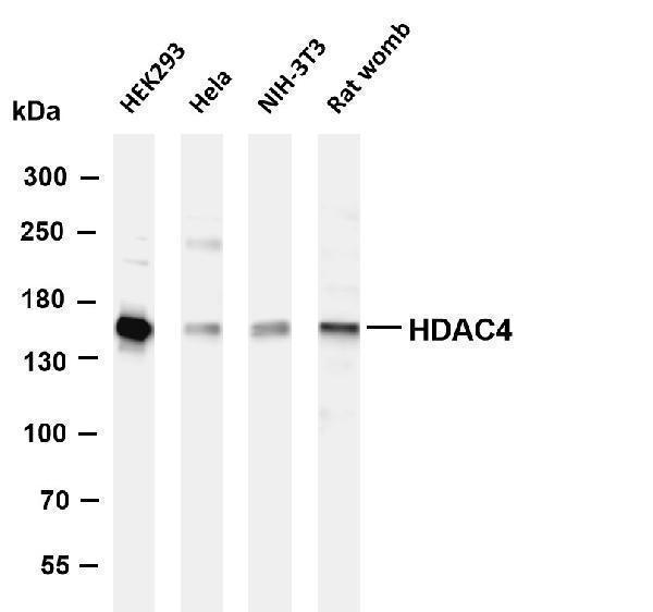 Various whole cell lysates were separated by 4-8% SDS-PAGE, and the membrane was blotted with anti-HDAC4 antibody