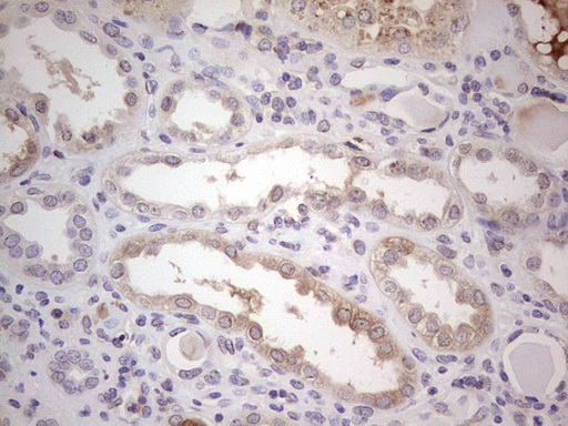 m00973 1 anti factor i cfi mouse monoclonal antibody clone id oti7c9 ihc testing 4