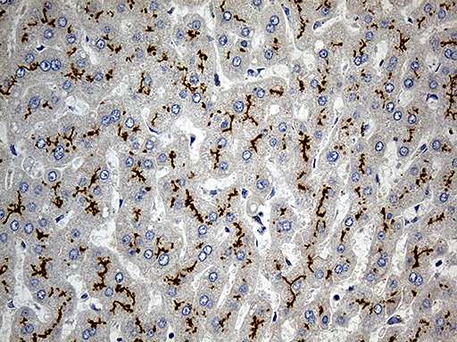 Immunohistochemical staining of paraffin-embedded Human liver tissue within the normal limits using anti-ABCC2 mouse monoclonal antibody
