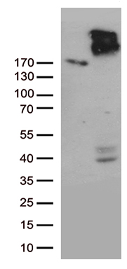 HEK293T cells were transfected with the pCMV6-ENTRY control (Left lane) or pCMV6-ENTRY ABCC2 (Right lane) cDNA for 48 hrs and lysed