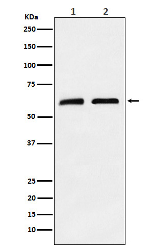 Western blot analysis of CLPX expression in (1) A673 cell lysate; (2) Mouse brain lysate