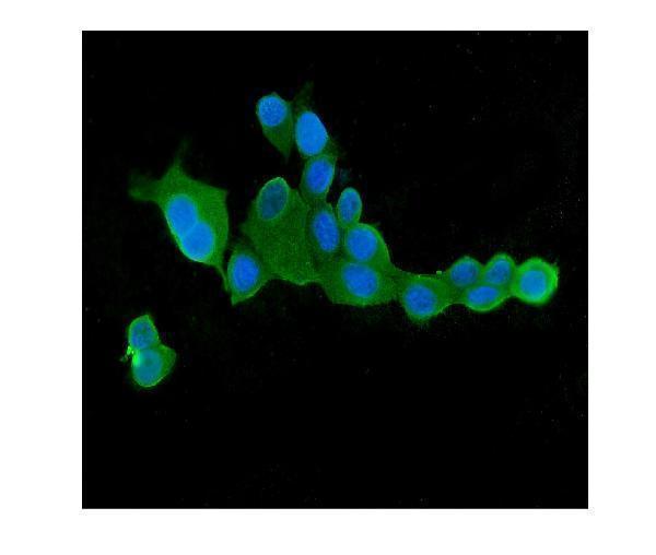  IF analysis of CLPX using anti-CLPX antibody (M00978)