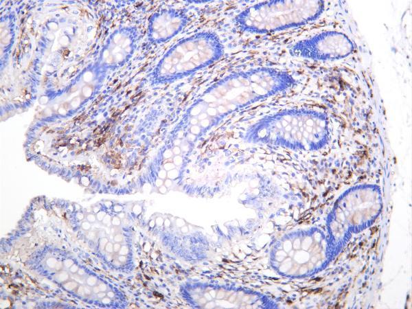 Human colon was stained with anti-S100B rabbit antibody
