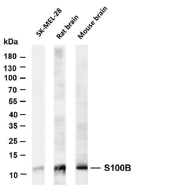 m00979 4 s100b primary antibodies wb testing 1