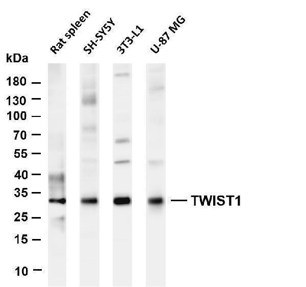 Various whole cell lysates were separated by 4-20% SDS-PAGE, and the membrane was blotted with anti-TWIST1 antibody