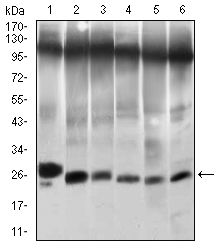 m00980 twist1 primary antiboties wb testing 1