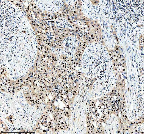 m00984 nedd4 primary antibodies ihc testing 1