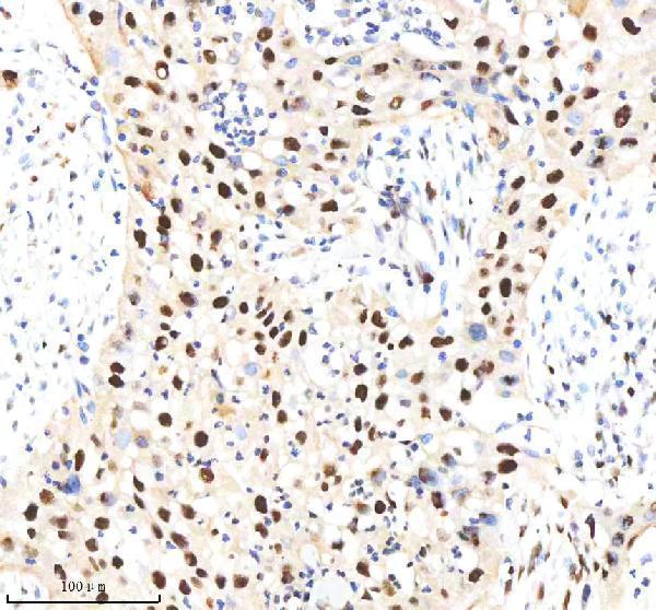 m00984 nedd4 primary antibodies ihc testing 2