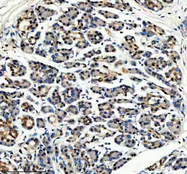m00984 nedd4 primary antibodies ihc testing 4