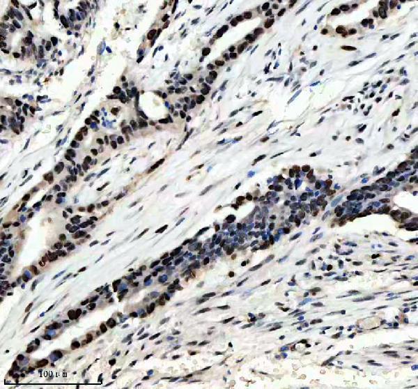 m00984 nedd4 primary antibodies ihc testing 5