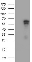 HEK293T cells were transfected with the pCMV6-ENTRY control (Left lane) or pCMV6-ENTRY ACD (Right lane) cDNA for 48 hrs and lysed
