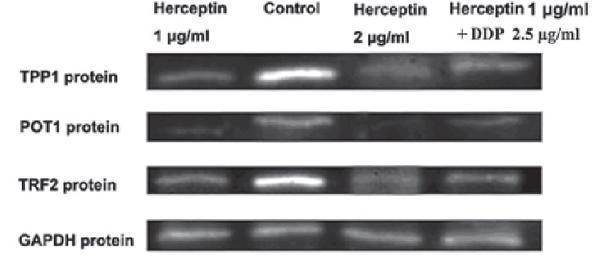 Figure from citation: Western blot analysis of TPP1 (also known as ACD) protein expression by using anti-ACD antibody in NCI-N87 cells