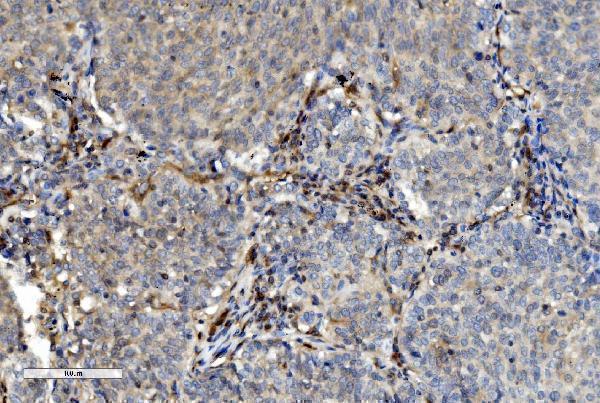  IHC analysis of PNP using anti-PNP antibody (M00988)