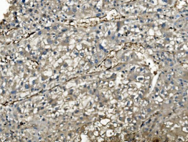  IHC analysis of PNP using anti-PNP antibody (M00988)