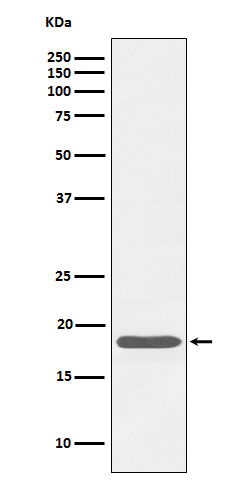 Western blot analysis of Caveolin-3 expression in human skeletal muscle cell lysate