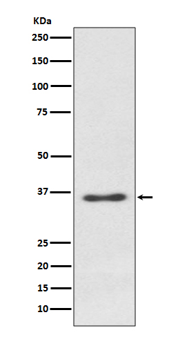 Western blot analysis of Syndecan 1 expression in Ramos cell lysate