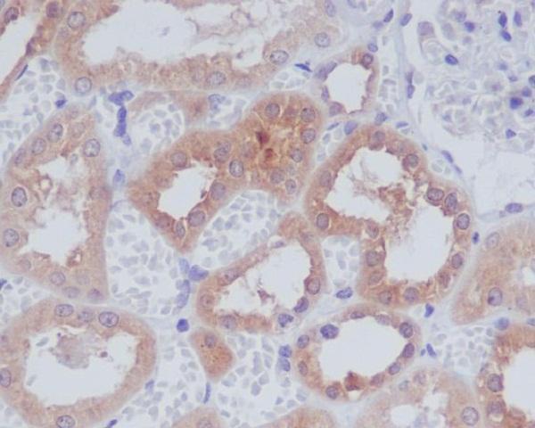 m00994 ihc