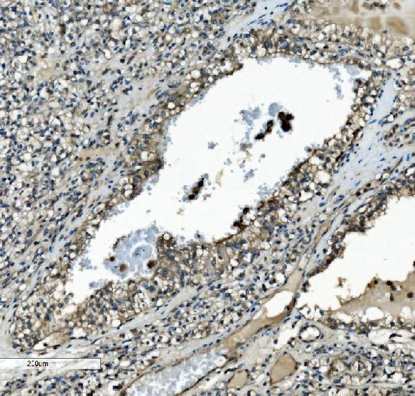  IHC analysis of MEK2/MAP2K2 using anti-MEK2/MAP2K2 antibody (M00996-3)