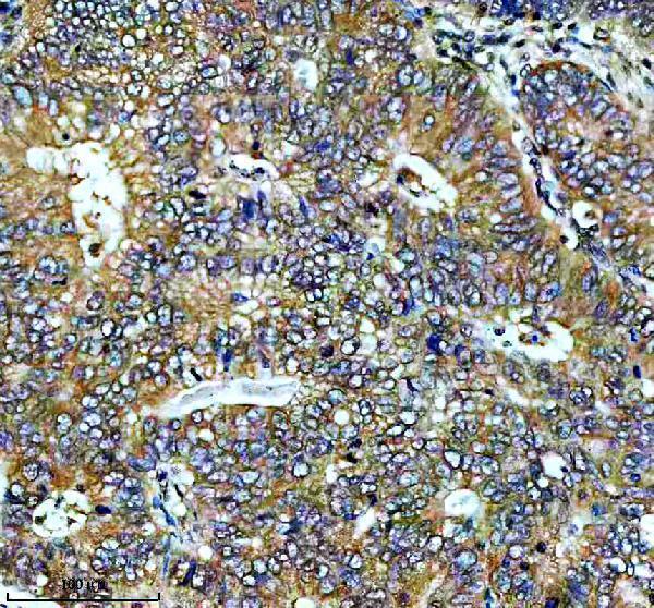 IHC analysis of MAP2K2 using anti-MAP2K2 antibody (M00996)