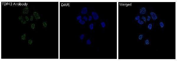 Immunofluorescent analysis of Hela cells, using TDP43 Antibody 