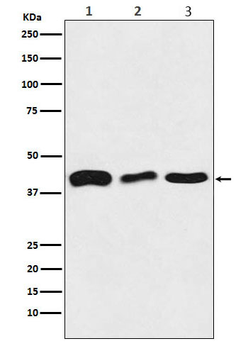 Western blot analysis of TDP43 expression in (1) HeLa cell lysate; (2) Mouse brain lysate; (3) Rat brain lysate