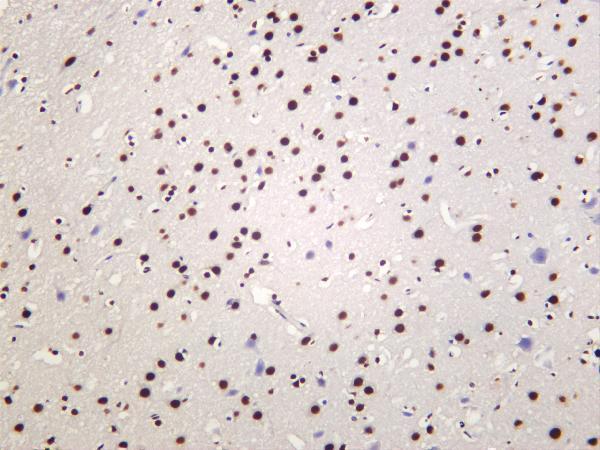 m01001 3 tardbp primary antibodies ihc testing 1