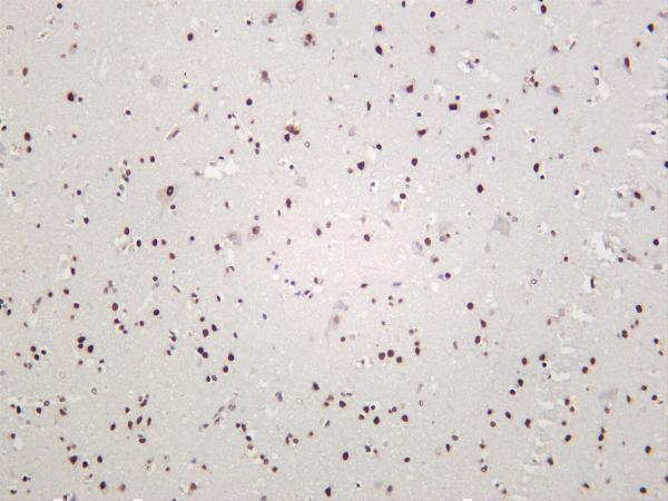 m01001 3 tardbp primary antibodies ihc testing 2