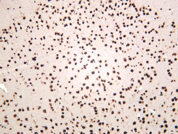 m01001 3 tardbp primary antibodies ihc testing 4