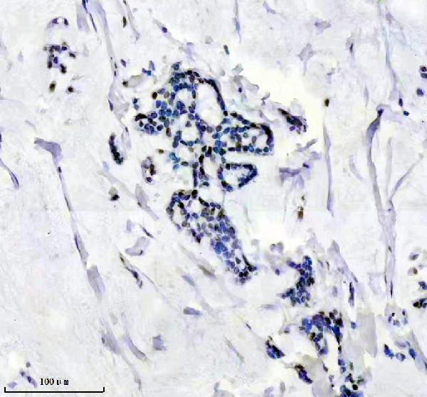 IHC analysis of TARDBP using anti-TARDBP antibody (M01001)