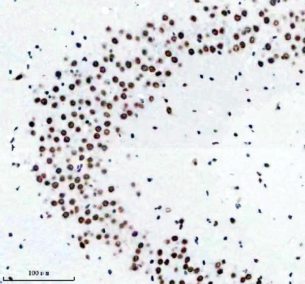 m01001 tardbp primary antibodies ihc testing 10