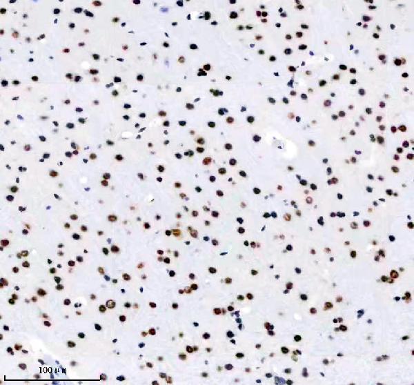 m01001 tardbp primary antibodies ihc testing 11