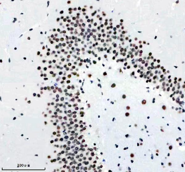 m01001 tardbp primary antibodies ihc testing 12