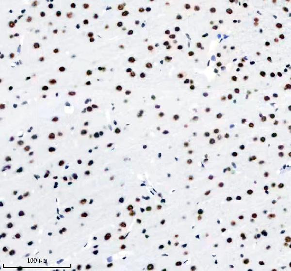 m01001 tardbp primary antibodies ihc testing 13