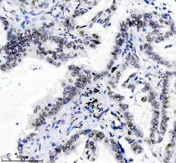 IHC analysis of TARDBP using anti-TARDBP antibody (M01001)