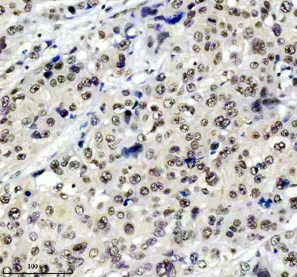 m01001 tardbp primary antibodies ihc testing 3