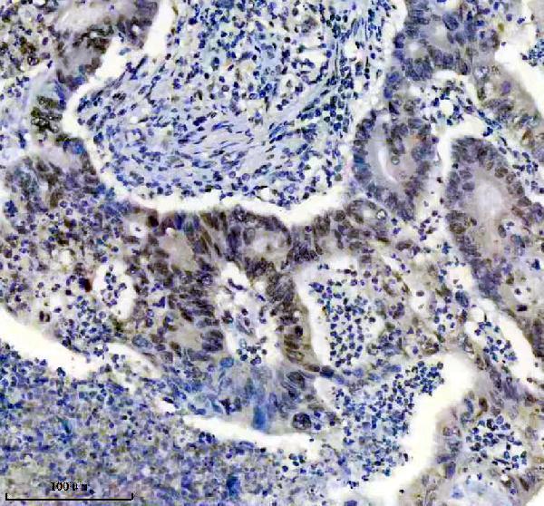 m01001 tardbp primary antibodies ihc testing 4