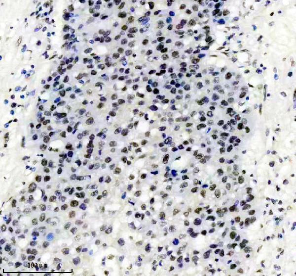 m01001 tardbp primary antibodies ihc testing 7