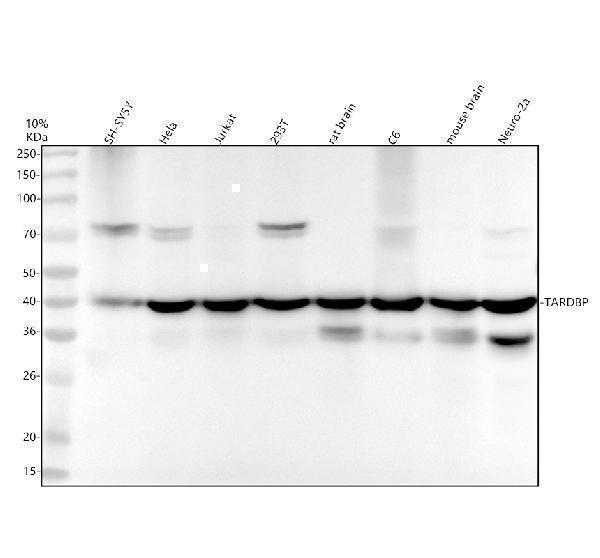 Western blot analysis of TARDBP using anti-TARDBP antibody (M01001)