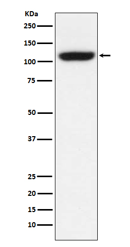 Western blot analysis of TRPM8 expression in A549 cell lysate