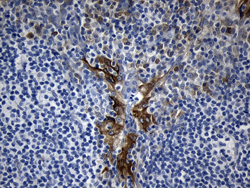 m01004 anti mok protein kinase mok mouse monoclonal antibody clone id oti6c12 ihc testing 3